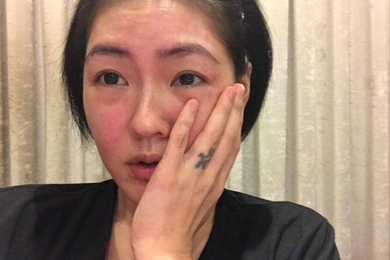 喝酒脸红还是脸白的容易醉（喝酒脸红和脸白哪个更能喝一点）(图5)