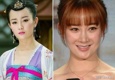 ​明星整容后遗症，整容的脸能维持多(整容后毁容的明星)