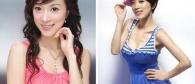 ​十大明星整容后却越整越丑，就算后悔也回不去了