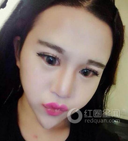 韩熙雅整容前照片 韩熙雅abby风油精事件