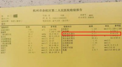 ​吃完下饭美味，男子变身“小紫人”！医生提醒，严重或致命