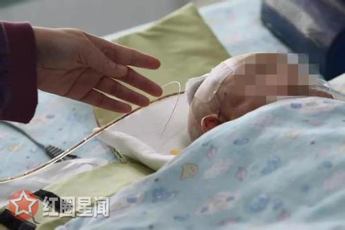扔苹果砸中女婴致昏迷 高空坠物究竟有多危险