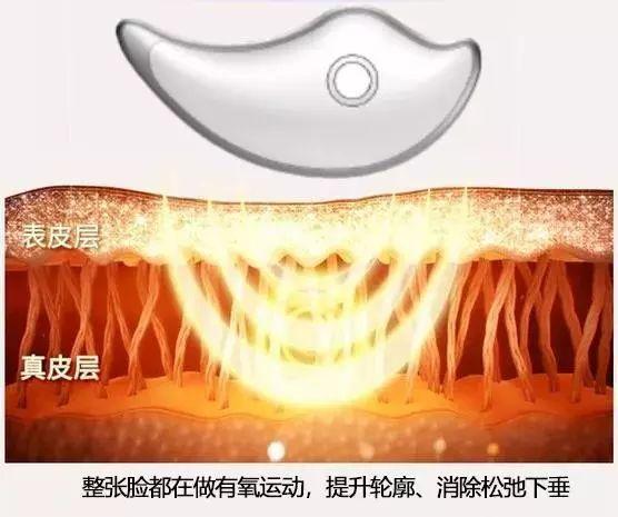 快速去皱去眼袋（有皱纹眼袋显老）(20)
