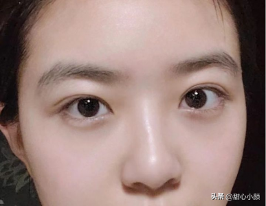 ​消除细纹 坚持一个月，眼周嫩得像18岁高中小妹妹