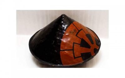 ​高危性行为一次感染可能性有多高